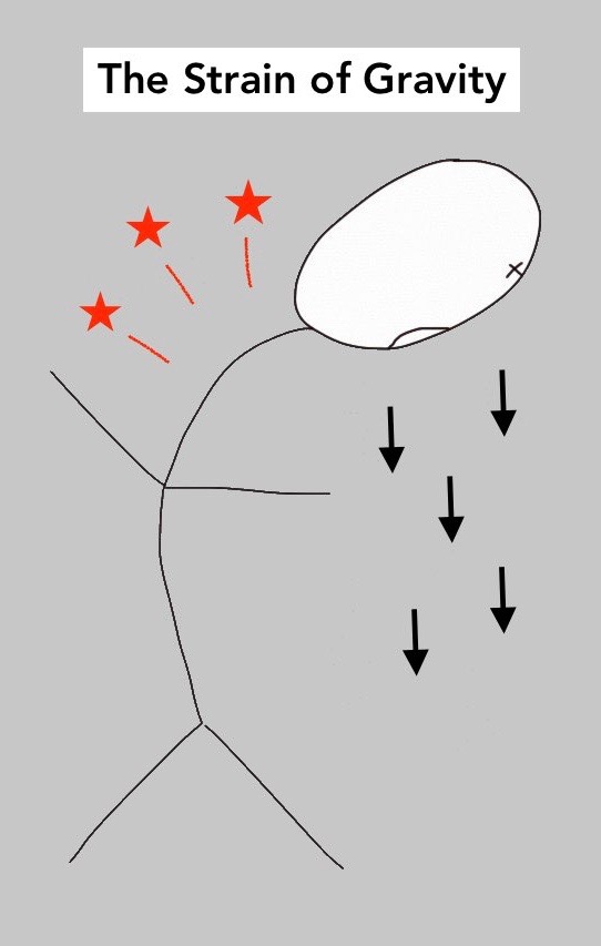 Forward head posture drawing