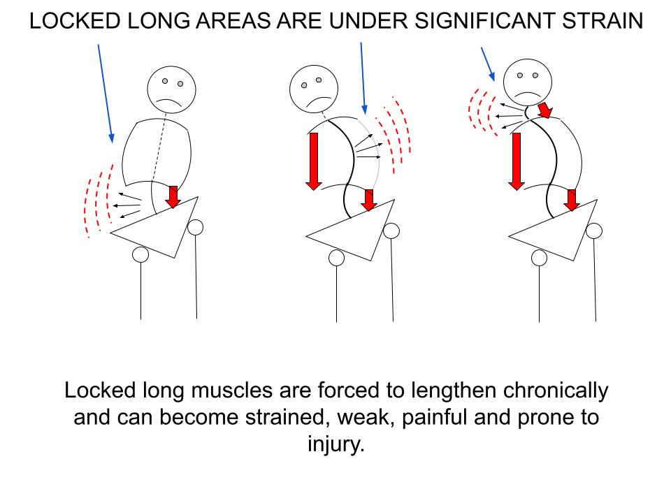 Locked long regions of the body under constant strain.