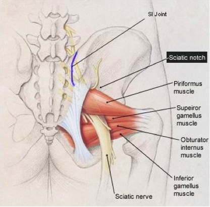 Pain in the Butt: Piriformis Syndrome vs. Sciatica